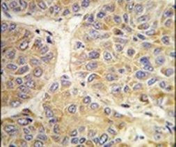 AASS Antibody in Immunohistochemistry (IHC)