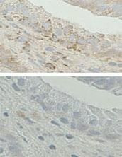 ERAB Antibody in Immunohistochemistry (IHC)