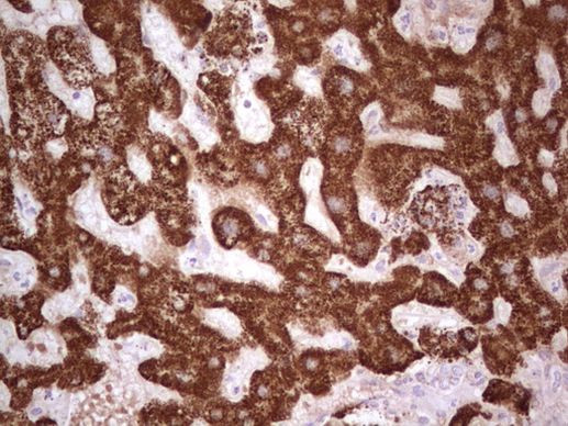ABAT Antibody in Immunohistochemistry (Paraffin) (IHC (P))
