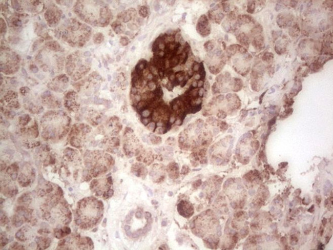 ABAT Antibody in Immunohistochemistry (Paraffin) (IHC (P))