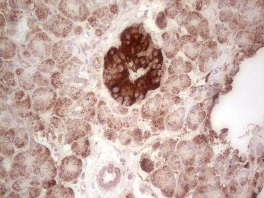 ABAT Antibody in Immunohistochemistry (Paraffin) (IHC (P))