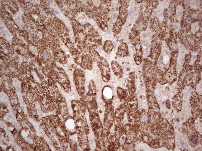 ABAT Antibody in Immunohistochemistry (Paraffin) (IHC (P))