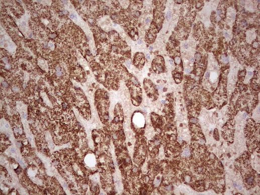 ABAT Antibody in Immunohistochemistry (Paraffin) (IHC (P))