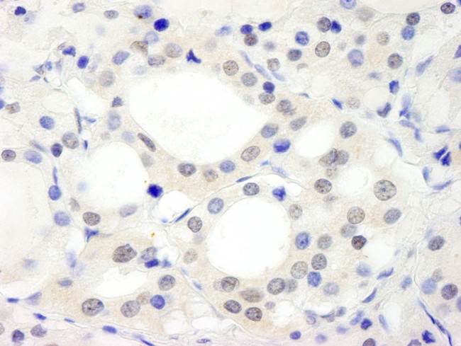 ABC2 Antibody in Immunohistochemistry (IHC)