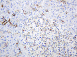 ABCB1 Antibody in Immunohistochemistry (Paraffin) (IHC (P))