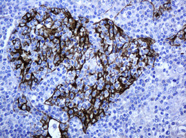 ABCB1 Antibody in Immunohistochemistry (Paraffin) (IHC (P))