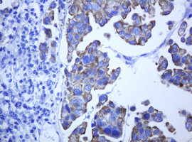 ABCB1 Antibody in Immunohistochemistry (Paraffin) (IHC (P))