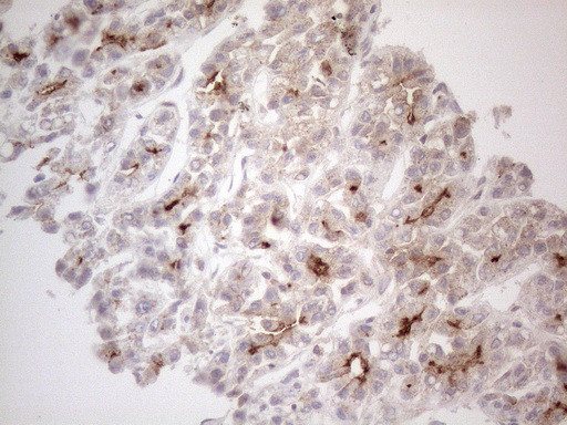 ABCB1 Antibody in Immunohistochemistry (Paraffin) (IHC (P))