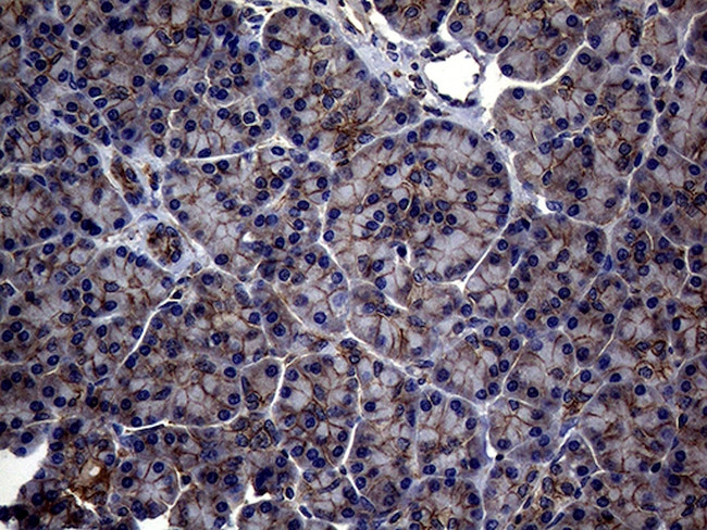 ABCB1 Antibody in Immunohistochemistry (Paraffin) (IHC (P))