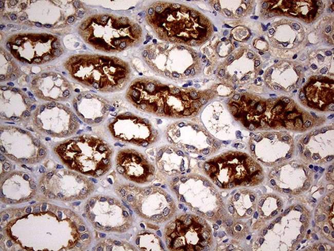 ABCB1 Antibody in Immunohistochemistry (Paraffin) (IHC (P))