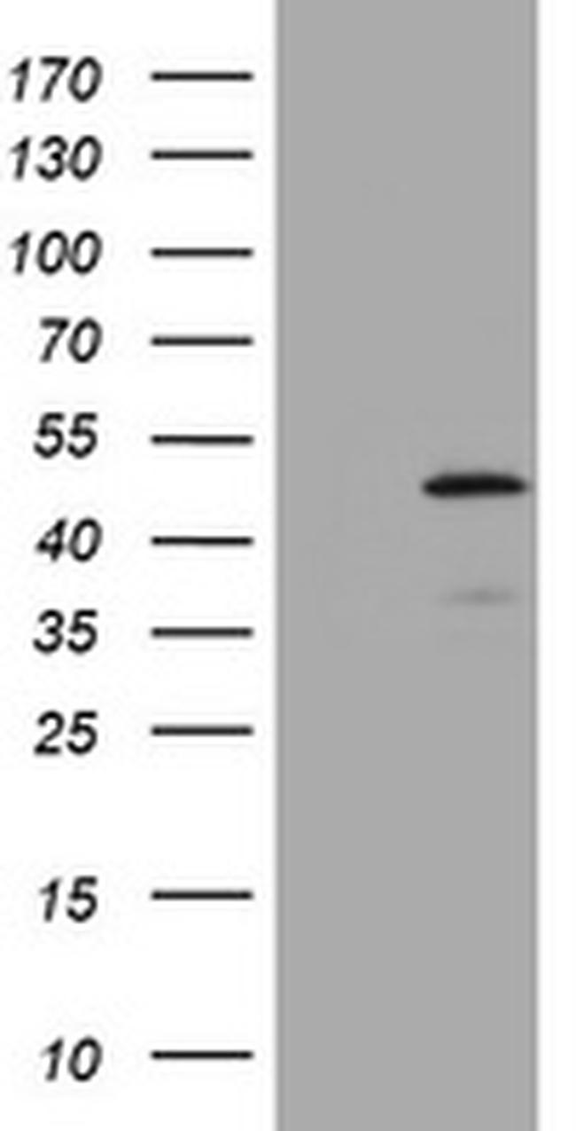 ABCB1 Antibody in Western Blot (WB)