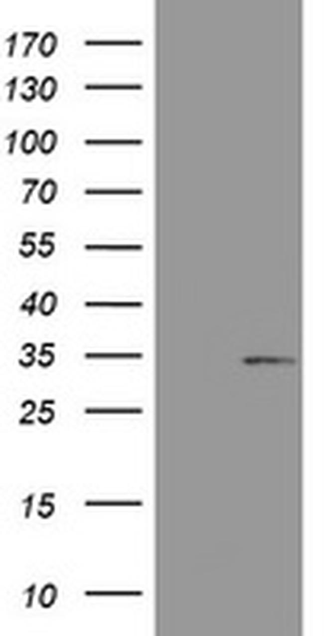 ABCB1 Antibody in Western Blot (WB)