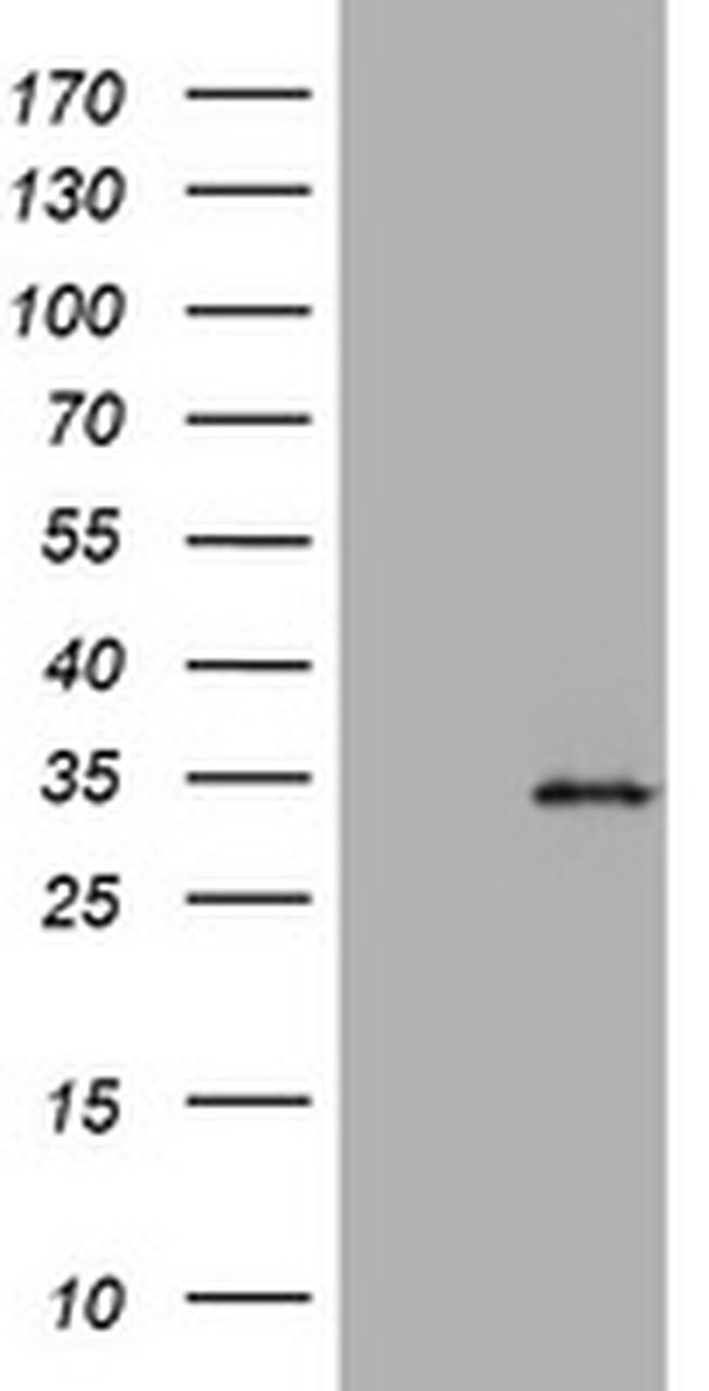 ABCB1 Antibody in Western Blot (WB)