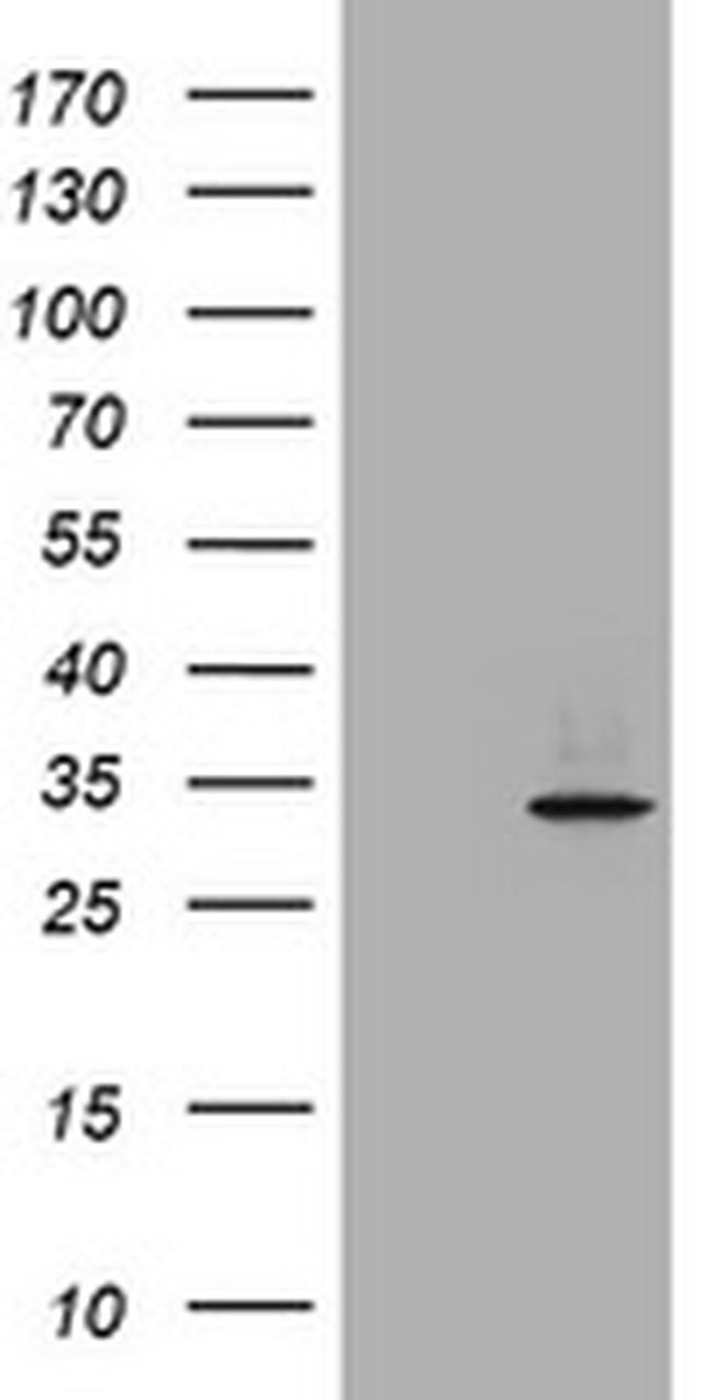 ABCB1 Antibody in Western Blot (WB)