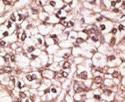 ABCB4 Antibody in Immunohistochemistry (IHC)