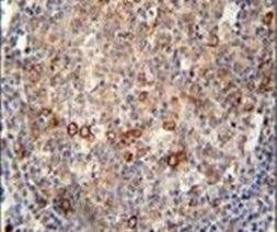 MRP7 Antibody in Immunohistochemistry (IHC)