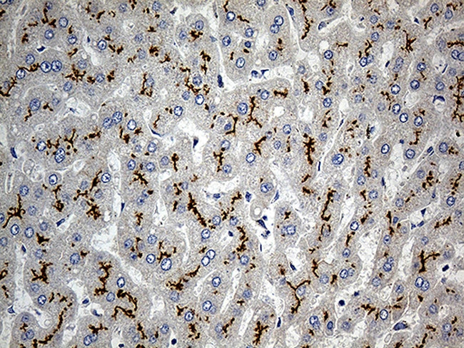 ABCC2 Antibody in Immunohistochemistry (Paraffin) (IHC (P))