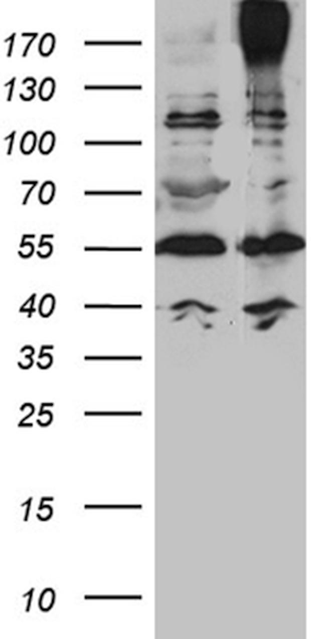 ABCC2 Antibody in Western Blot (WB)