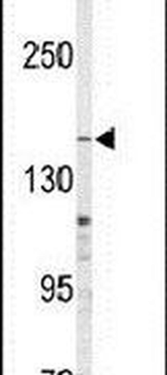 MRP4 Antibody in Western Blot (WB)