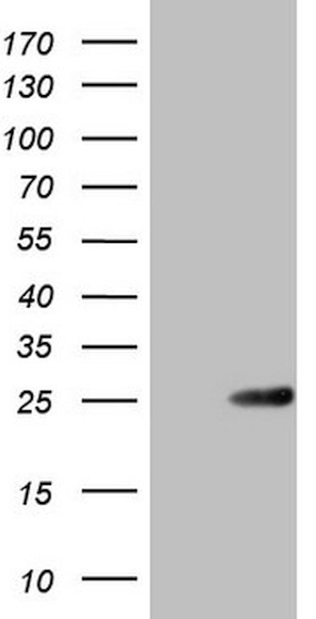 ABCC5 Antibody in Western Blot (WB)