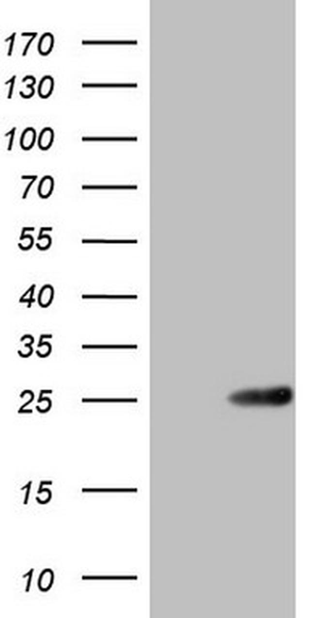 ABCC5 Antibody in Western Blot (WB)