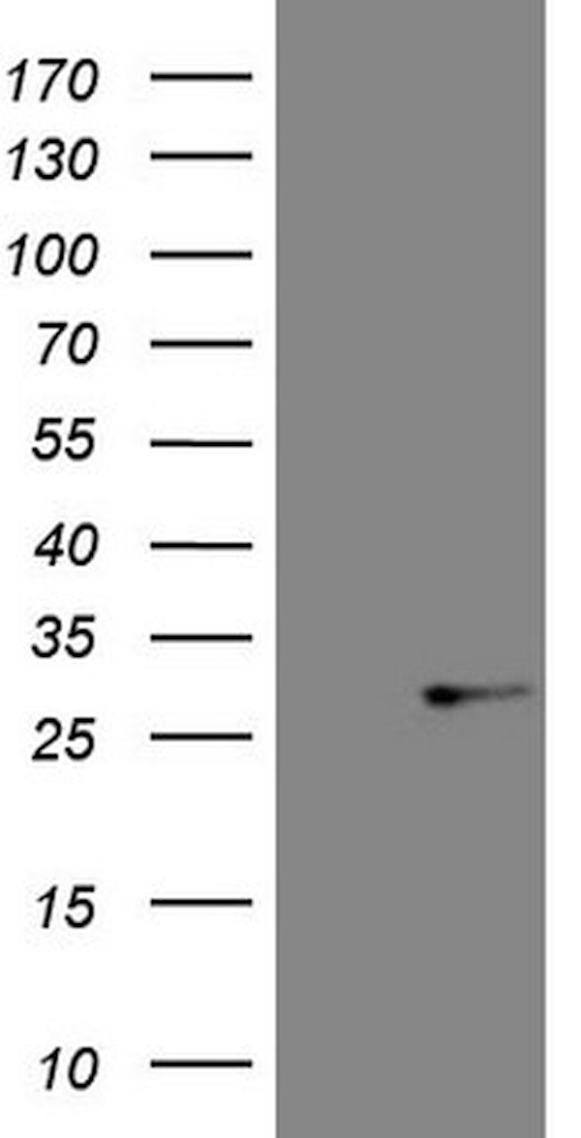 ABCC5 Antibody in Western Blot (WB)