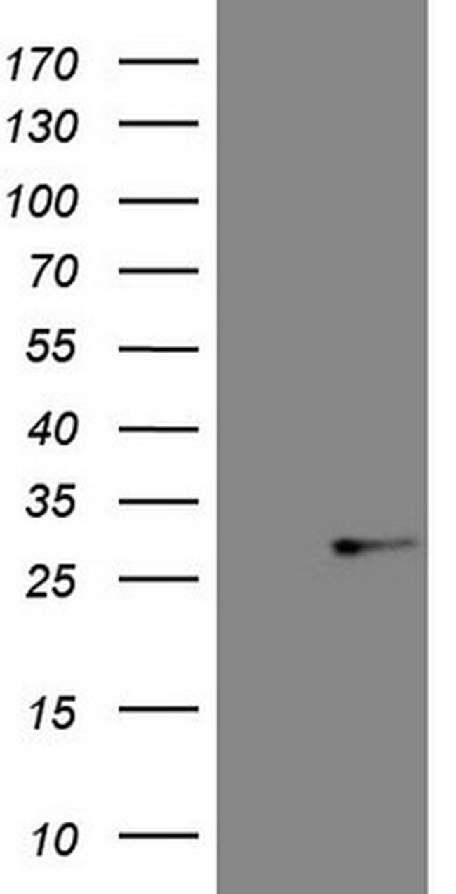 ABCC5 Antibody in Western Blot (WB)