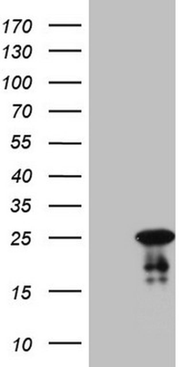 ABCC5 Antibody in Western Blot (WB)