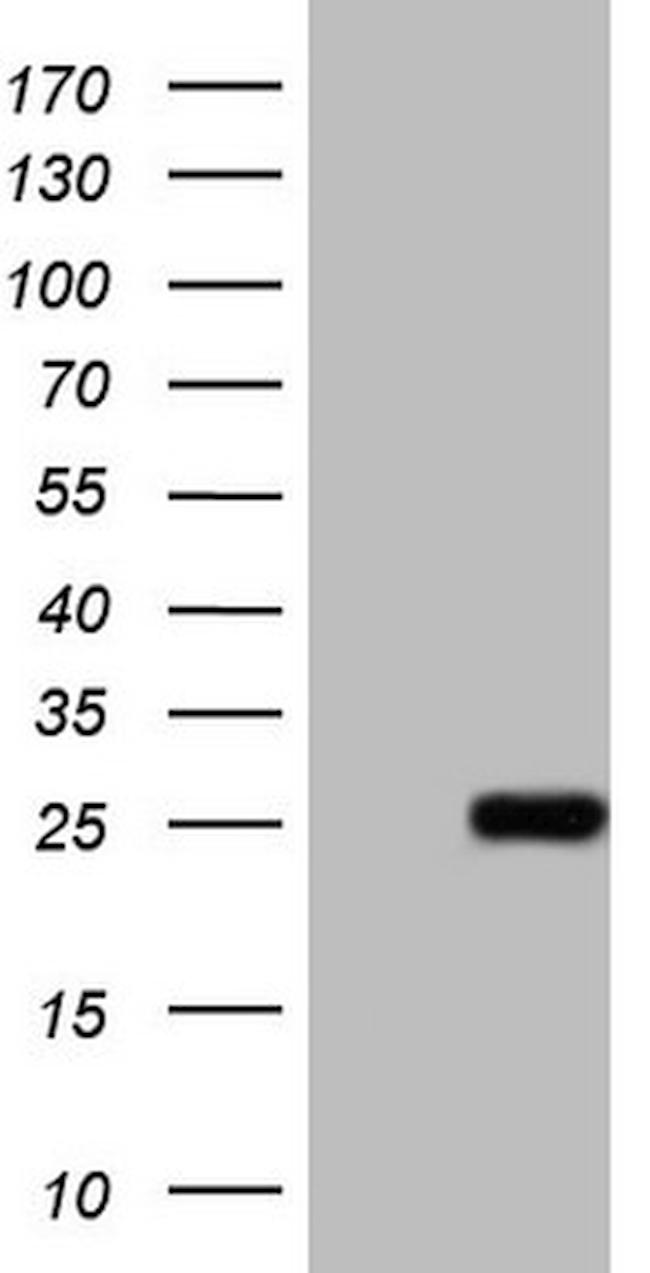 ABCC5 Antibody in Western Blot (WB)