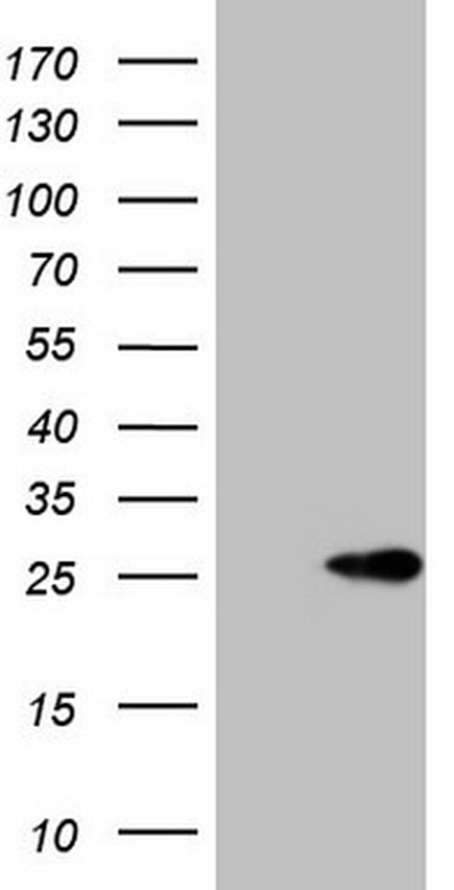 ABCC5 Antibody in Western Blot (WB)