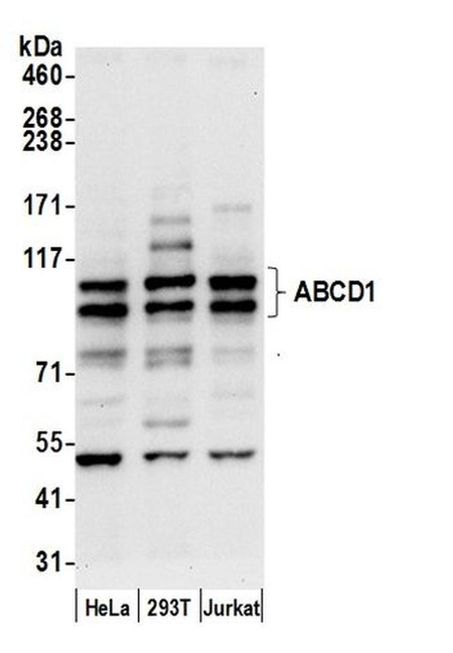 ABCD1 Antibody in Western Blot (WB)