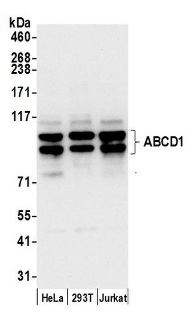ABCD1 Antibody in Western Blot (WB)