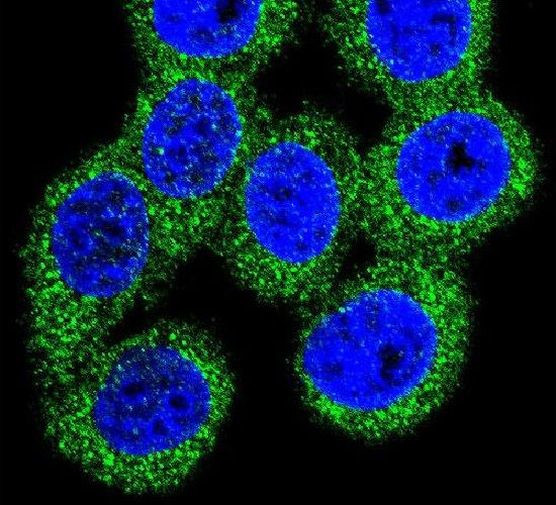 ABCG1 Antibody in Immunocytochemistry (ICC/IF)