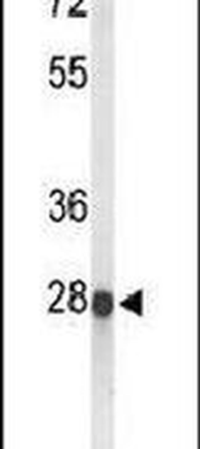 ABHDB Antibody in Western Blot (WB)