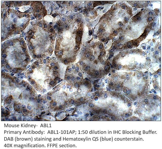 ABL1 Antibody in Immunohistochemistry (IHC)