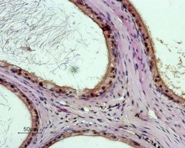 Bombesin Receptor 3 (extracellular) Antibody in Immunohistochemistry (Paraffin) (IHC (P))