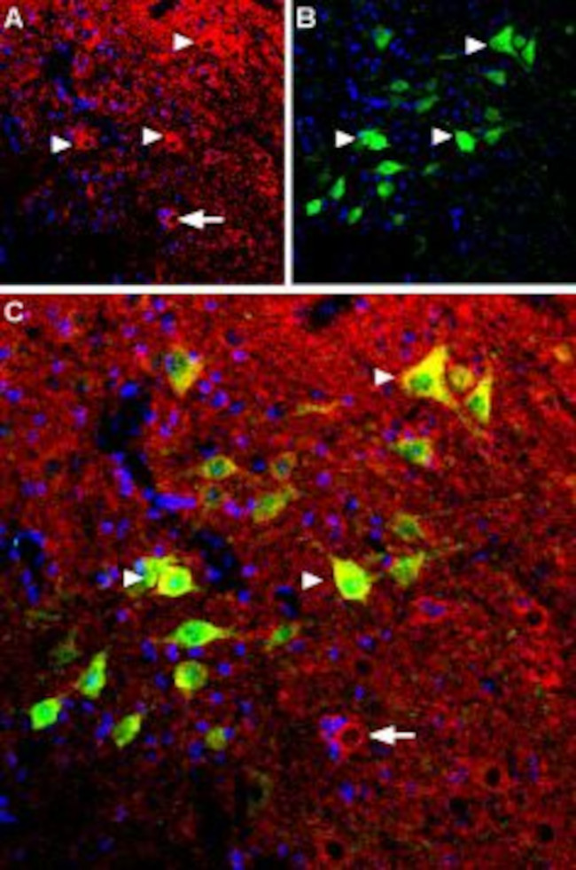 B2 Bradykinin Receptor (BDKRB2) Antibody in Immunohistochemistry (IHC)