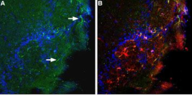 BAI1 (extracellular) Antibody in Immunohistochemistry (Frozen) (IHC (F))
