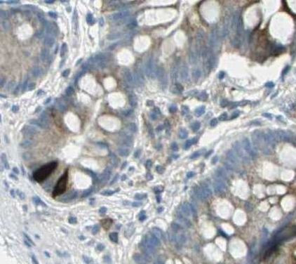 GIP Antibody in Immunohistochemistry (Paraffin) (IHC (P))
