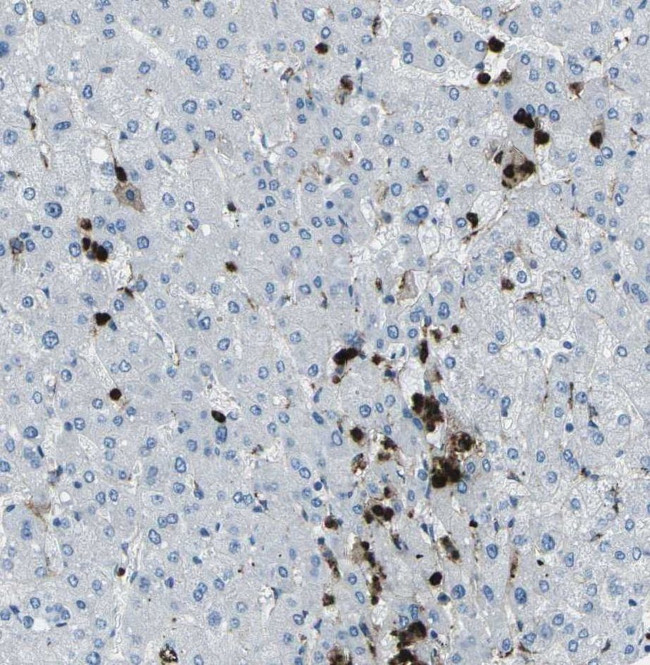 FCN1 Antibody in Immunohistochemistry (IHC)
