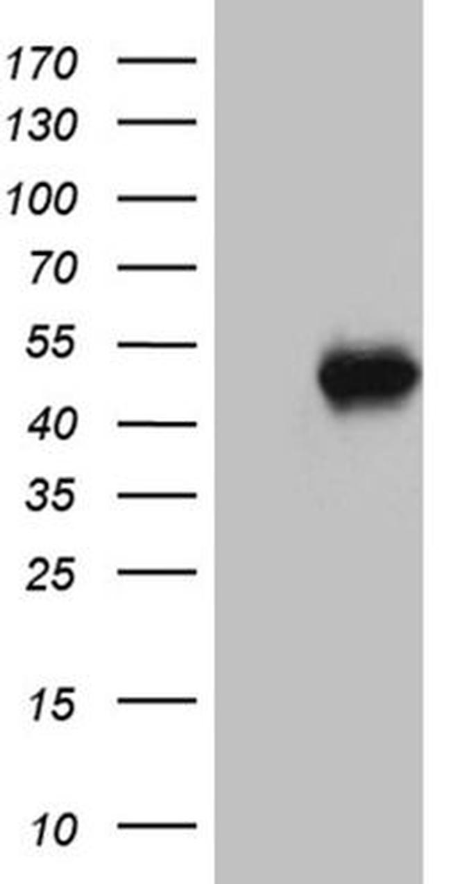 ABTB1 Antibody in Western Blot (WB)