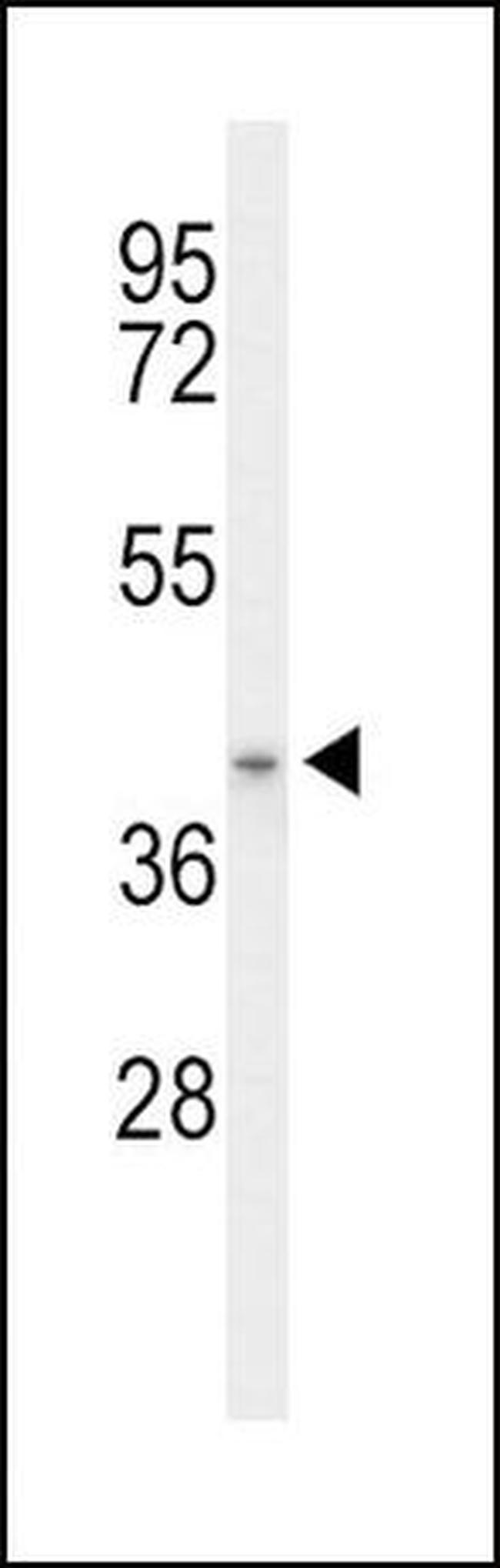 ACAD8 Antibody in Western Blot (WB)