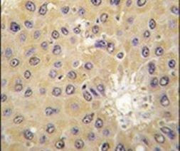 ACAT1 Antibody in Immunohistochemistry (IHC)
