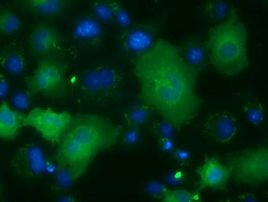 ACAT2 Antibody in Immunocytochemistry (ICC/IF)