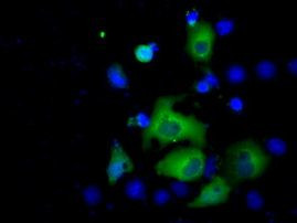 ACAT2 Antibody in Immunocytochemistry (ICC/IF)