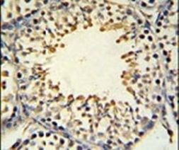 ACSBG2 Antibody in Immunohistochemistry (IHC)