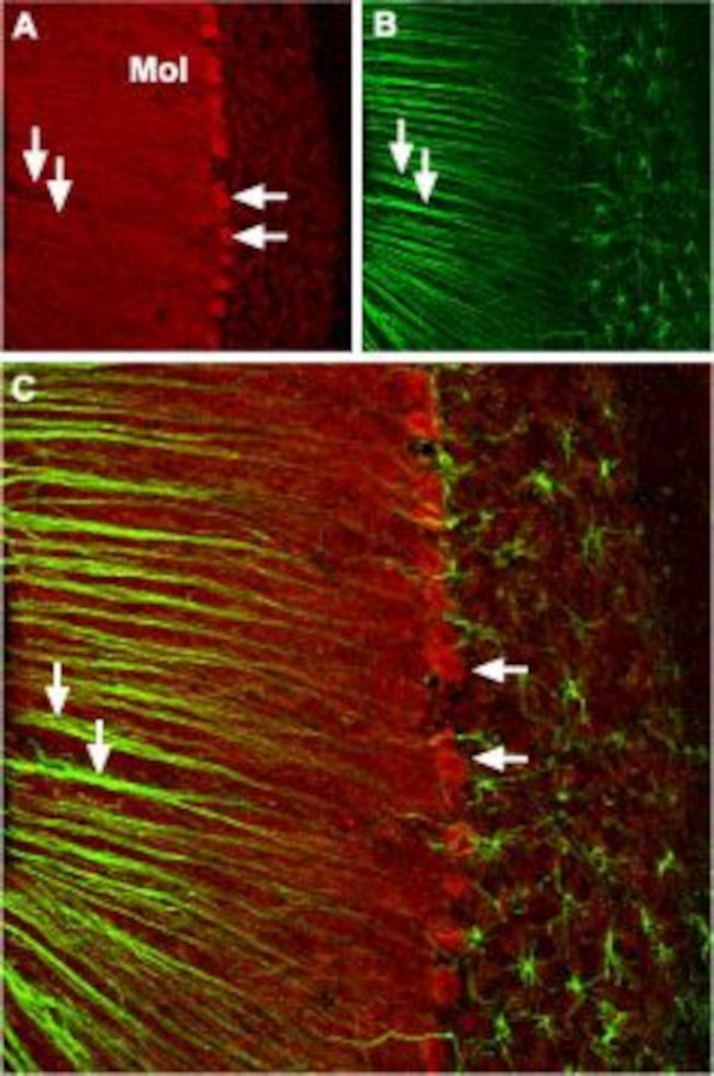 CACNA1A (CaV2.1) Antibody in Immunohistochemistry (IHC)
