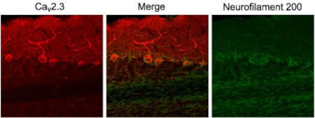 CaV2.3 (CACNA1E) Antibody in Immunohistochemistry (IHC)