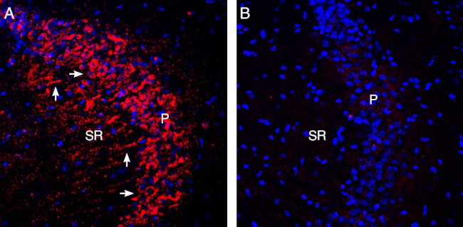 CaV3.3 (CACNA1I) Antibody in Immunohistochemistry (Frozen) (IHC (F))