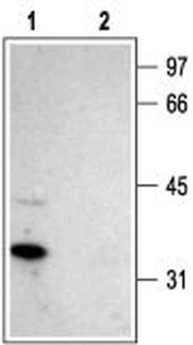 Stargazin Antibody in Western Blot (WB)
